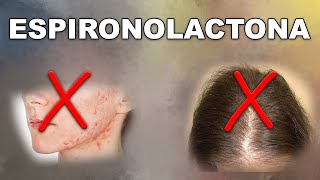 ESPIRONOLACTONA ¿solución ACNÉ y ALOPECIA femenina [upl. by Aerehs623]