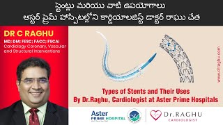 Types of stents  What is stents  Stents treatment  Dr Raghu [upl. by Aryad]