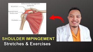 SHOULDER IMPINGEMENT STRETCHES amp EXERCISES  PHYSICAL THERAPY [upl. by Knowlton438]