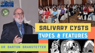 TMT Salivary Cysts by Dr Barton Branstetter [upl. by Anirret671]