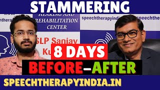 BeforeAfter  Stammering Speech Therapy Within 8 Days  By slpsanjaykumar  AIIMS Delhi Alumnus [upl. by Yetty]