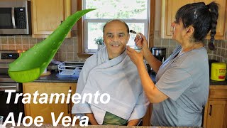 Tratamiento de Gel Aloe Vera Para la Cara [upl. by Mathis]