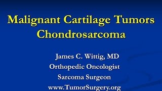 Orthopedic Oncology Course  Malignant Cartilage Tumors Chondrosarcoma  Lecture 6 [upl. by Ahsiek]