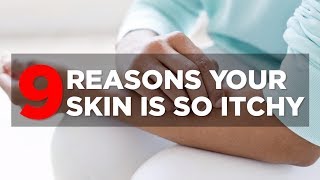 9 Reasons Your Skin Is So Itchy  Health [upl. by Eiramyllek]