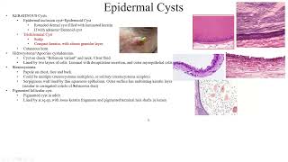 Pathology Made EasySystemic Pathology 14Skin Diseases4Epidermal proliferations and neoplasms1 [upl. by Yrad]