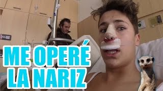 ME OPERÉ LA NARIZ  Juanpa Zurita [upl. by Colly]