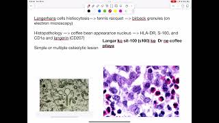 Langerhans cell histiocytosis mnemonics [upl. by Haleelahk559]