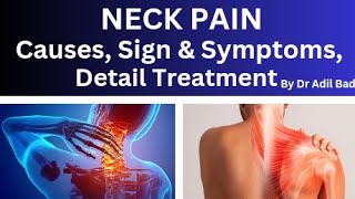 Neck Pain Causes Sign amp Symptoms and Detail Treatment गर्दन में दर्द 91doctors [upl. by Navarro530]