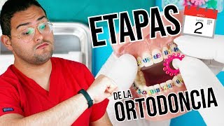 ETAPAS  FASES del tratamiento de BRACKETS ¿Cuanto TIEMPO DURA la ORTODONCIA [upl. by Eyllib966]