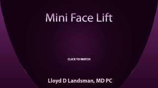 Mini Facelift 3D Video  Dr Landsman [upl. by Loggins]