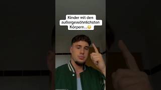 Kinder mit den AUSSERGEWÖHNLICHSTEN Körpern…😳  foryou trending fypシ゚viral trend deutsch fy [upl. by Mur]