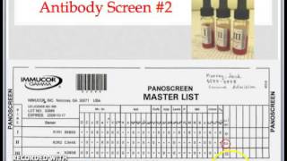 Practical Transfusion Medicine Part 1  Blood Typing Antibody Screen and Crossmatch [upl. by Humbert430]