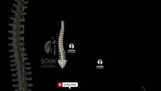 Scoliosis Animation  Different types of scoliosis [upl. by Marjana]