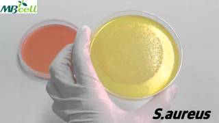 Mannitol Salt Agar [upl. by Otha]