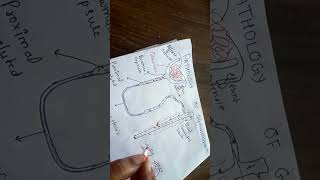 pathogenesis of glomerulonephritis [upl. by Ardith255]