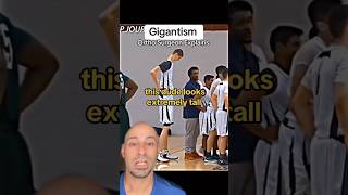 GIGANTISM  Doctor Explains shorts [upl. by Lynelle927]