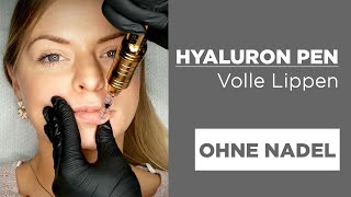 Hyaluron Pen LIPPEN VOLUMEN schmerzfrei und ohne Nadel [upl. by Adnowal]