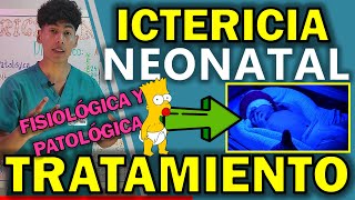 ICTERICIA NEONATAL TRATAMIENTO  GuiaMed [upl. by Aubrie753]