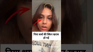 Nia Sharma Health Problem  Nia Sharma Viral Video shorts [upl. by Aisanahta]