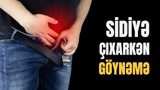 SİDİK KİSƏSİ xəstəlikləri Kimdə olur  Rüfət Əsədbəyli [upl. by Alag400]