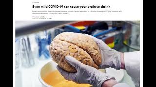 COVID Causes Brain Damage Studies Show As Officials Capitulate to Virus from S4A Livestream 120 [upl. by Sillert]