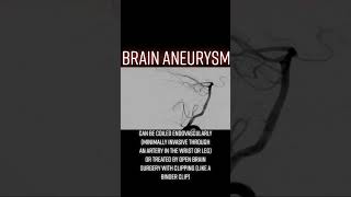 Brain aneurysm [upl. by Burris148]