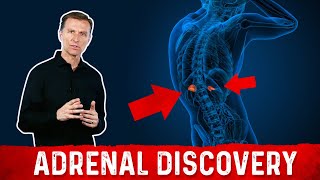 Adrenal Discovery – High Cortisol Levels Blood Sugar Levels amp Adrenal Stress – Dr Berg [upl. by Kcirnek]