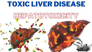 Toxic Liver Disease Hepatotoxicity  How do you know if you have liver toxicity  247nht [upl. by Einnaej140]