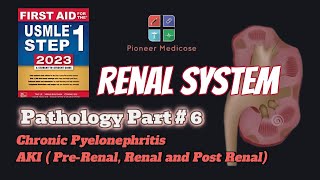 Acute Kidney Injury and Chronic Pyelonephritis for USMLE step 1pathology Part 6UrduHindi [upl. by Risley]