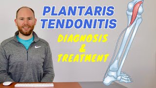 Plantaris Muscle Pain  Plantaris Rupture and Plantaris Tendonitis [upl. by Urbani]