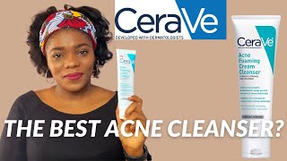 Cerave Acne Foaming Cream Cleanser Review  Dr Janet [upl. by Nennahs]