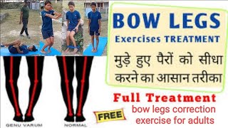 Bow legs ko kaise thik kare in hindi genu varum correction exercises [upl. by Alimac]