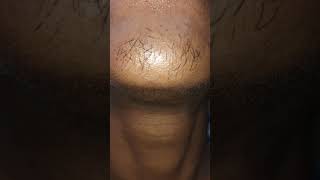 minoxidil 5 beard growth new pic  explore cover music [upl. by Amees749]