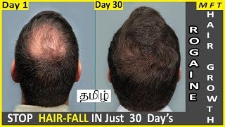 Rogaine Minoxidil for Hair Regrowth in 30 days  Where to buy Rogaine in India  Mens Fashion Tamil [upl. by Budworth]