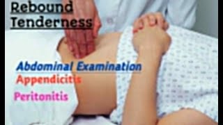 Rebound tenderness appendicitis sign Abdominal assessment health assessment in Hindi Urdu [upl. by Nilrac]