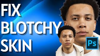 How to Fix Blotchy Skin in Photoshop [upl. by Dulcie741]