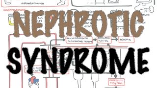 Nephrotic Syndrome  Overview Sign and symptoms pathophysiology [upl. by Johnston]