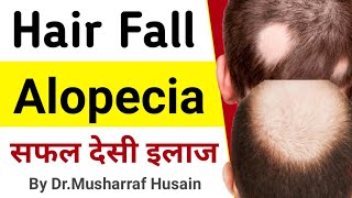 Hair Fall Treatment  गिरते बालों का देसी इलाज  Baldness And Alopecia Treatment [upl. by Tizes]