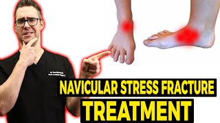 Navicular Stress Fracture Treatment Exercise Shoes amp Stretches [upl. by Doughty]