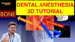 EASY Inferior Alveolar Nerve BLOCK Technique The Best Tutorial 3D IAN dental injection anesthesia [upl. by Asa]