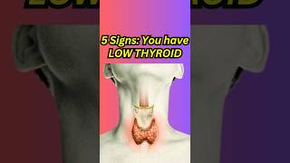 5 Signs that you have LOW THYROID  Hypothyroidism thyroid hypothyroidism healthtips shorts [upl. by Aij]