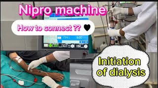 Initiation of hemodialysis via AV fistula nipro machine hemodialysishospital ckdpatient [upl. by Sochor]