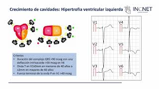 Electrocardiograma Anormal [upl. by Inajna]