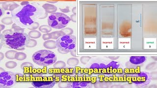 Blood smear Preparation l Leishmans Staining Techniques l Leishmans Staining Procedure ln Odia l [upl. by Ellata550]