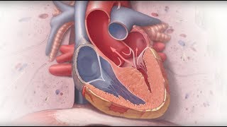 Genetics and Cardiomyopathy  Mayo Clinic [upl. by Enilram]