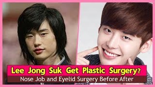 Lee Jong Suk Get Plastic Surgery Nose Job and Eyelid Surgery Before After [upl. by Alecram]