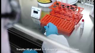 Wondfo Antigen Test [upl. by Hutchison]