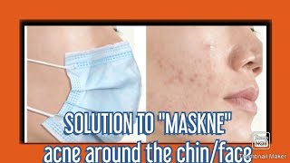 SOLUTION TO MASK ACNE  PROVEN AND EFFECTIVE [upl. by Gabor]