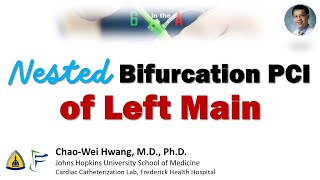 Nested Bifurcation Stenting of Left Main Trifurcation [upl. by Ipoillak]