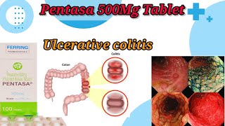 Pentasa 500Mg Tablet UseBenefitsSide EffectsUlcerative Colitis TreatmentFull Reviews [upl. by Anelyak349]